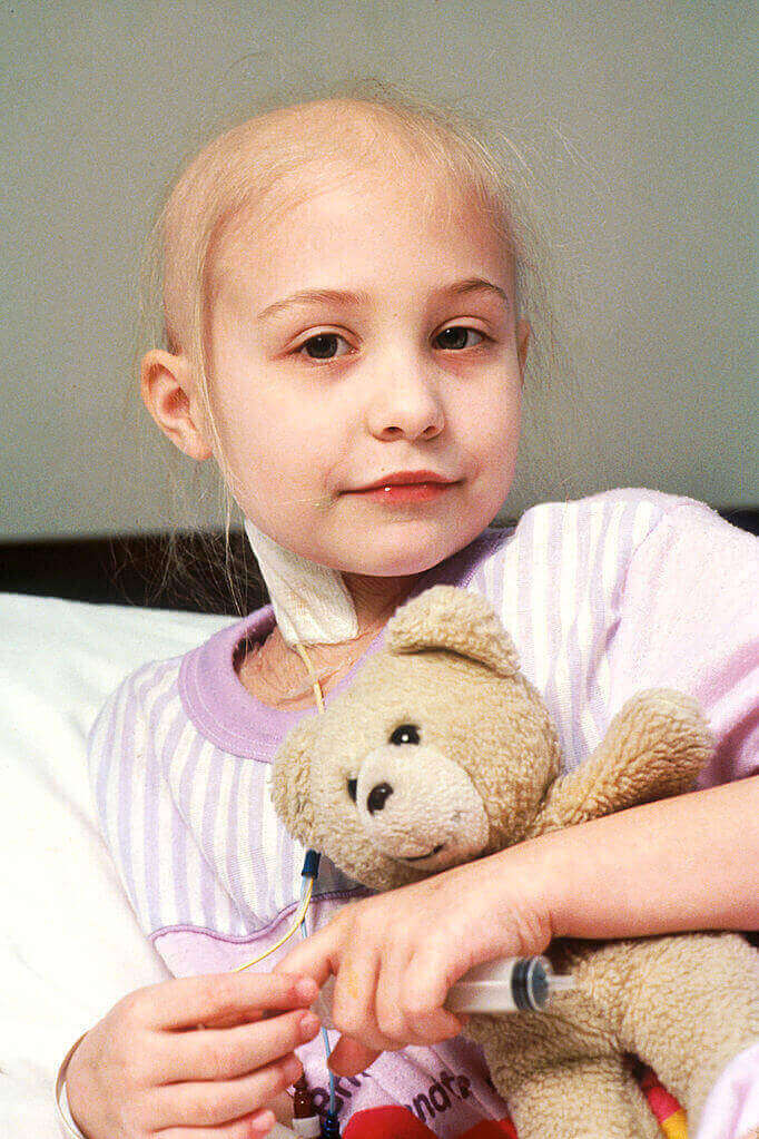 Childhood-Leukemia