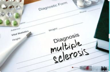 Multiple-sclerosis