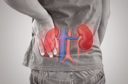 how to keep your kidneys healthy