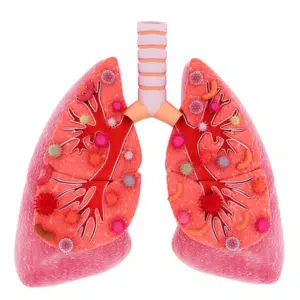 Healthy-Lungs